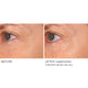 Wrinkle Blur Targeted Treatment - NassifMD® Skincare