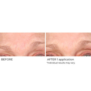 Wrinkle Blur Targeted Treatment - NassifMD® Skincare