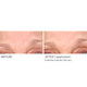 Wrinkle Blur Targeted Treatment - NassifMD® Skincare