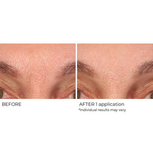 Wrinkle Blur Targeted Treatment - NassifMD® Skincare