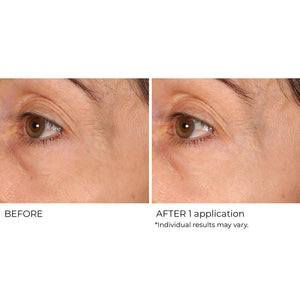 Wrinkle Blur Targeted Treatment - NassifMD® Skincare