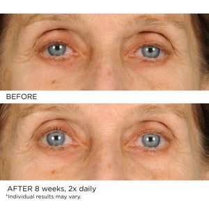 Undereye Anti-Aging Smoother