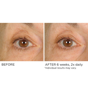 Undereye Anti-Aging Smoother