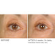 Undereye Anti-Aging Smoother