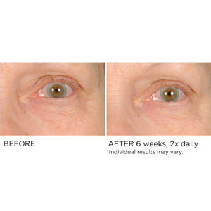 Undereye Anti-Aging Smoother