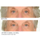 Undereye Anti-Aging Smoother